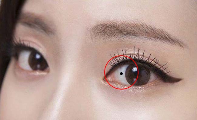 Nốt ruồi ở trong mắt phải có ý nghĩa gì, có phải là dấu hiệu của điềm lành?